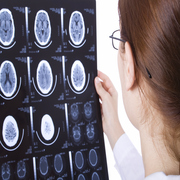 Newly Dignoised with Relapsing-Remitting MS Group
