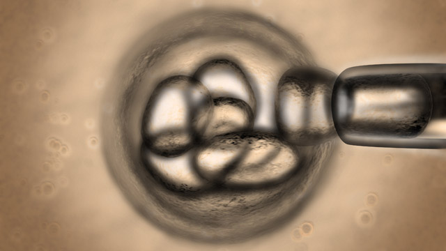 Stem cell research for Multiple Schlerosis