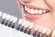 Veneers Image