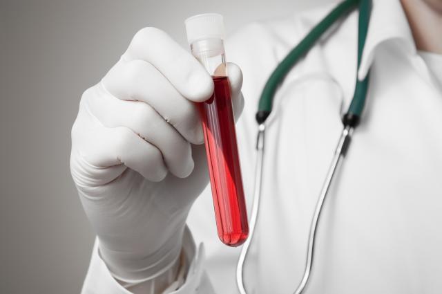 blood sample