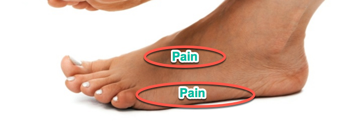extreme pain on outside of foot