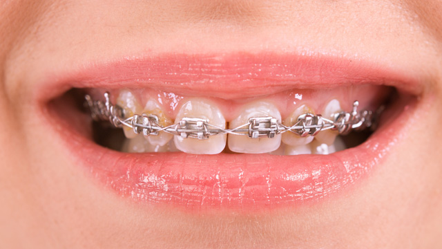 Dental health and self-esteem are linked