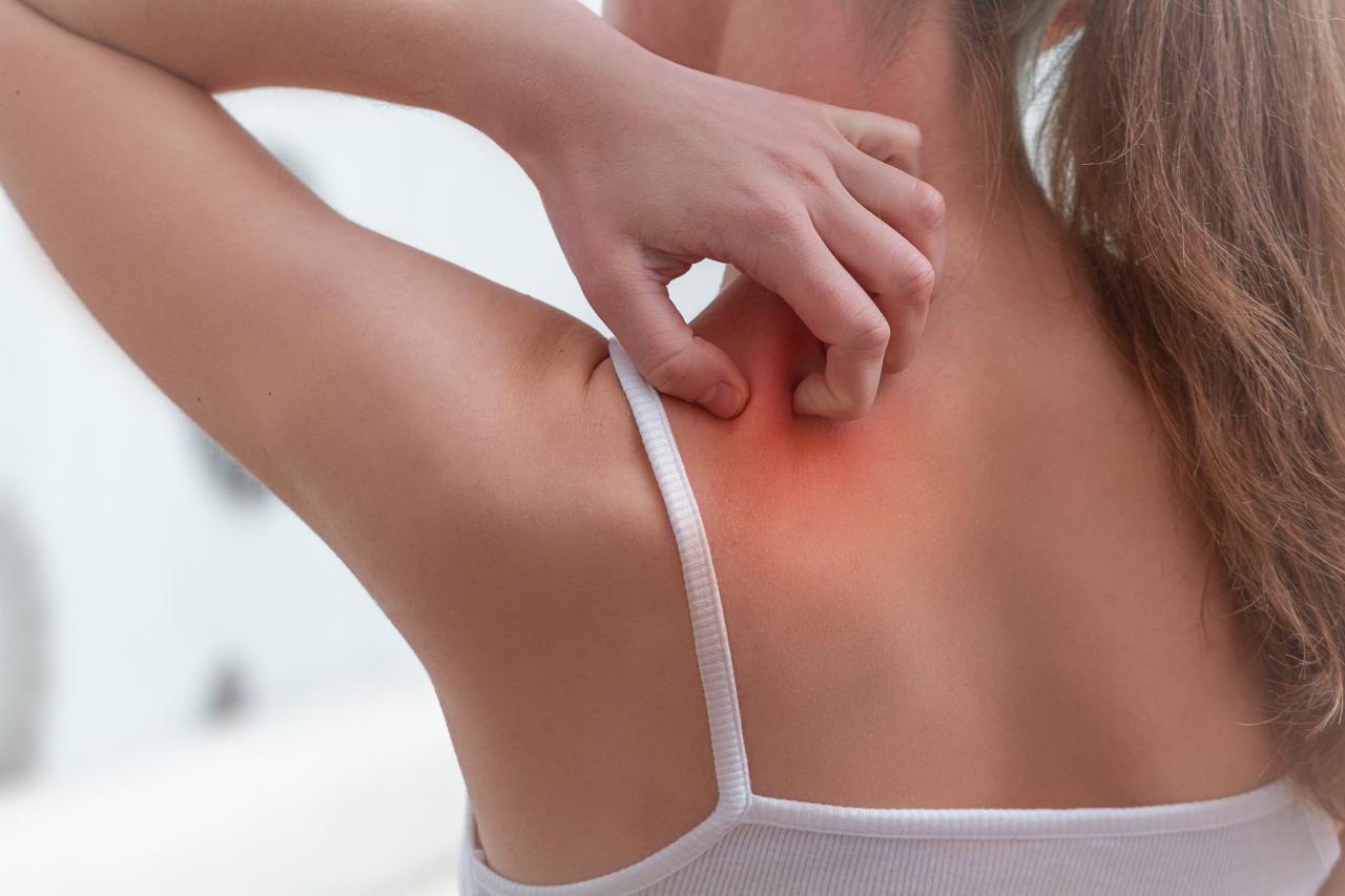 Do Seasonal Allergies Cause Itchy Skin Allergies Question