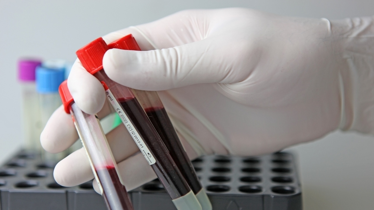 5 Common STDs Affecting Men and Women Today