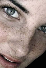 How to prevent freckles??