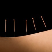 weight loss can be increased with acupuncture