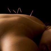 acupuncture may provide relief for pain such as sciatica