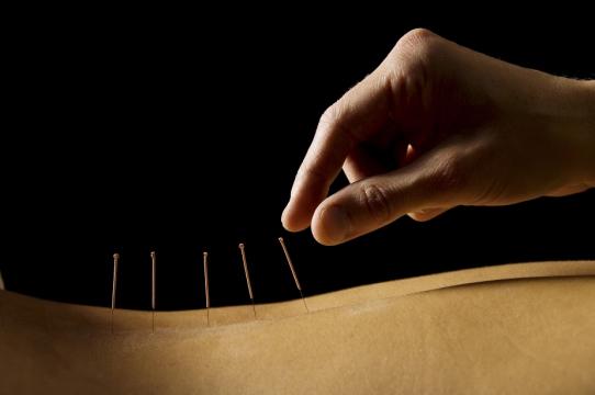 Acupuncture to Relieve Cancer Treatment Side Effects