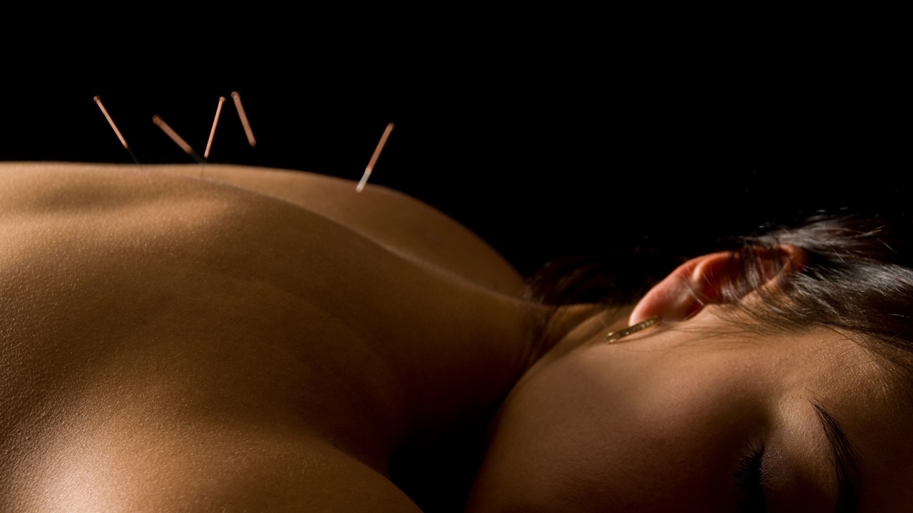 acupuncture needles can bring relief