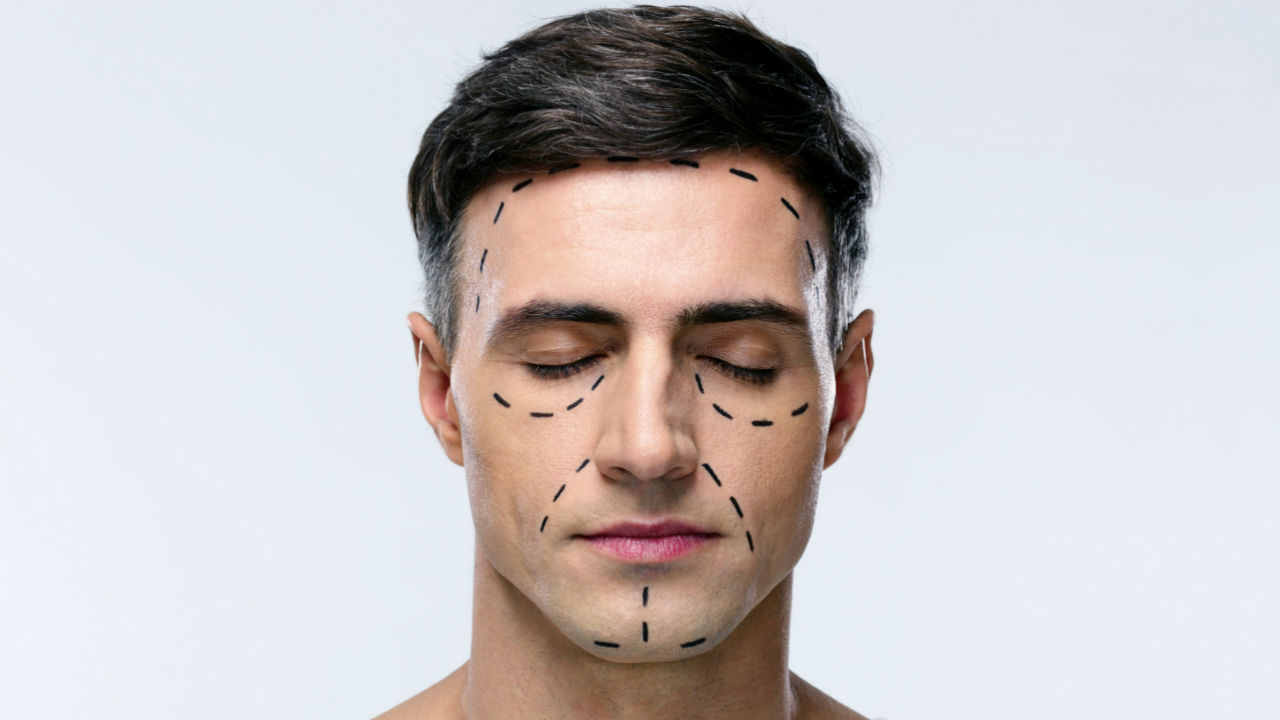 Top 5 Cosmetic Surgeries for Men
