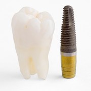 Is dental implant surgery the solution for you?