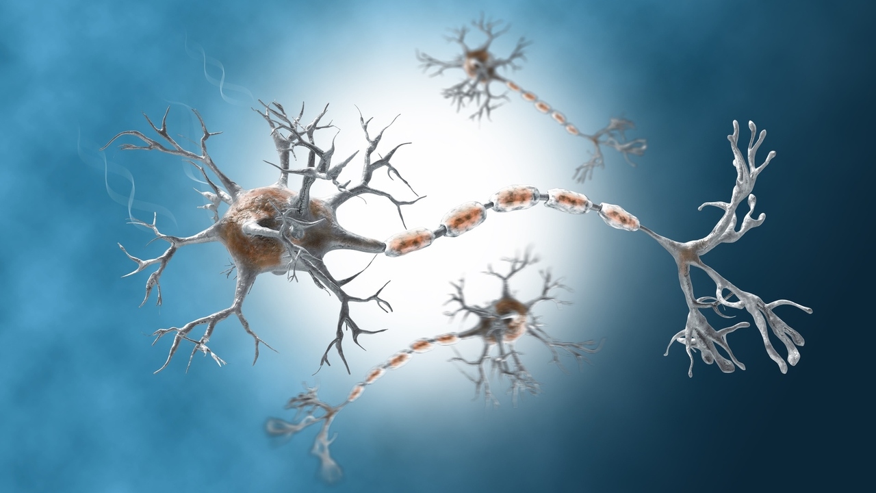 Differences Between MS and Guillain-Barré Syndrome