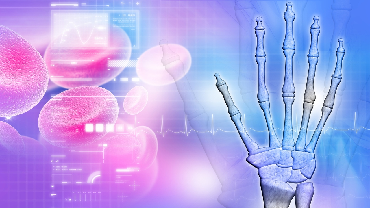 5 Facts About Arthritis That May Just Surprise You