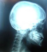 Headache related image