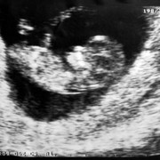 development of the twelve week fetus