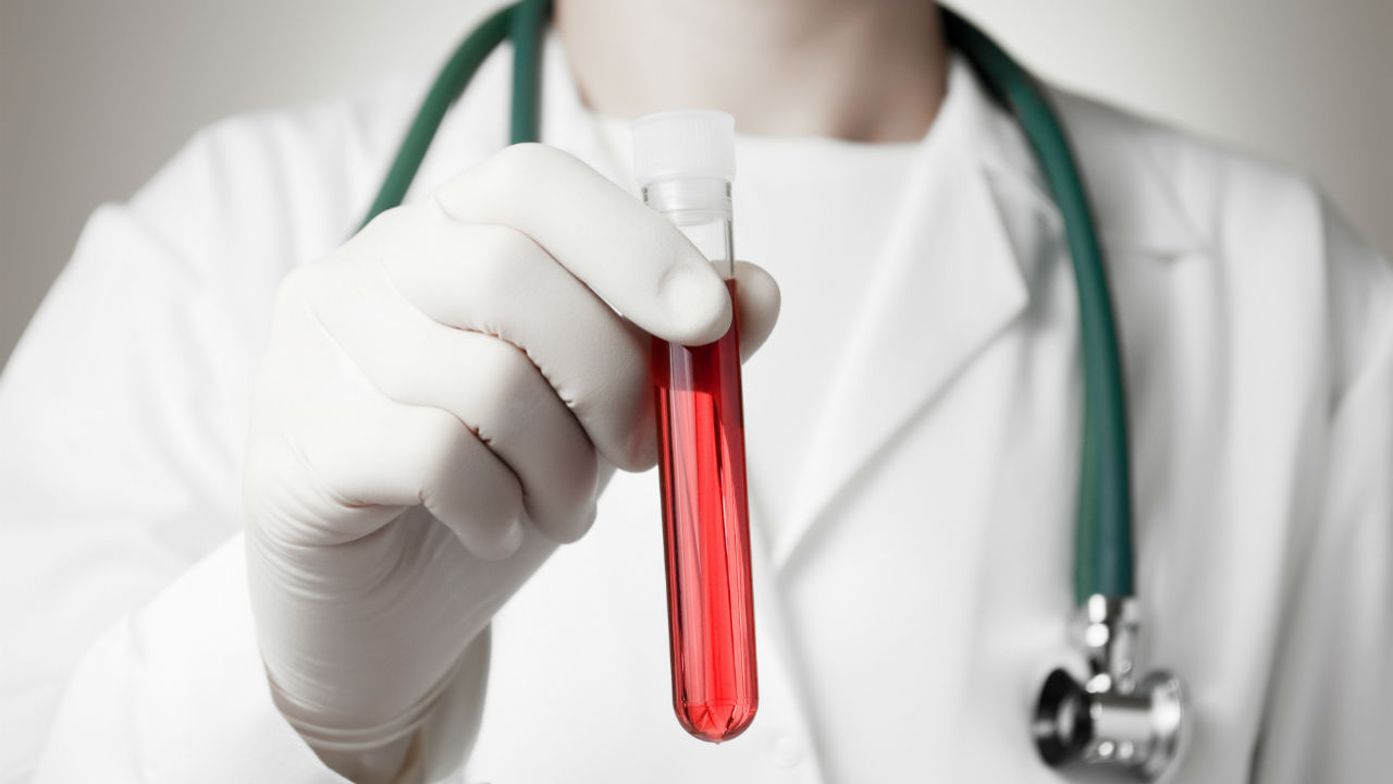 Theranos: The Lab Test Reinvented