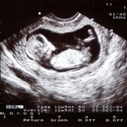 Your 12 Week Fetus