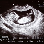 your-fetus-at-week-12