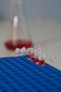 AIDS / HIV related image
