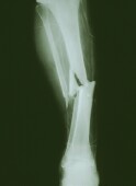 Bones & Joints related image