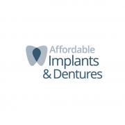 affordableimplant