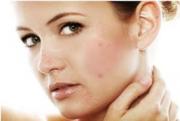 naturalskincarer